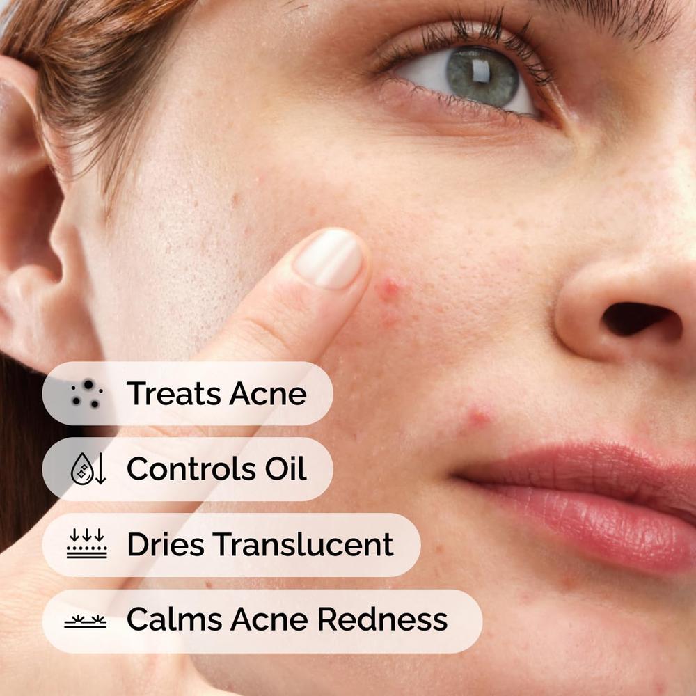 THE ORDINARY TRATAMIENTO DE AZUFRE 10% POLVO A CREMA PARA ACNÉ | 5 ML. - 2