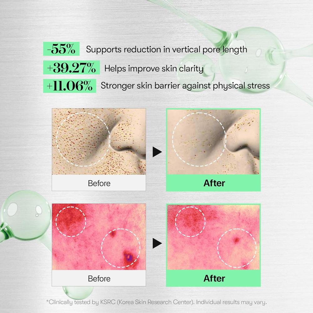 VT COSMETICS CICA REEDLE SHOT 100 + CREMA EN CÁPSULAS PDRN - 4
