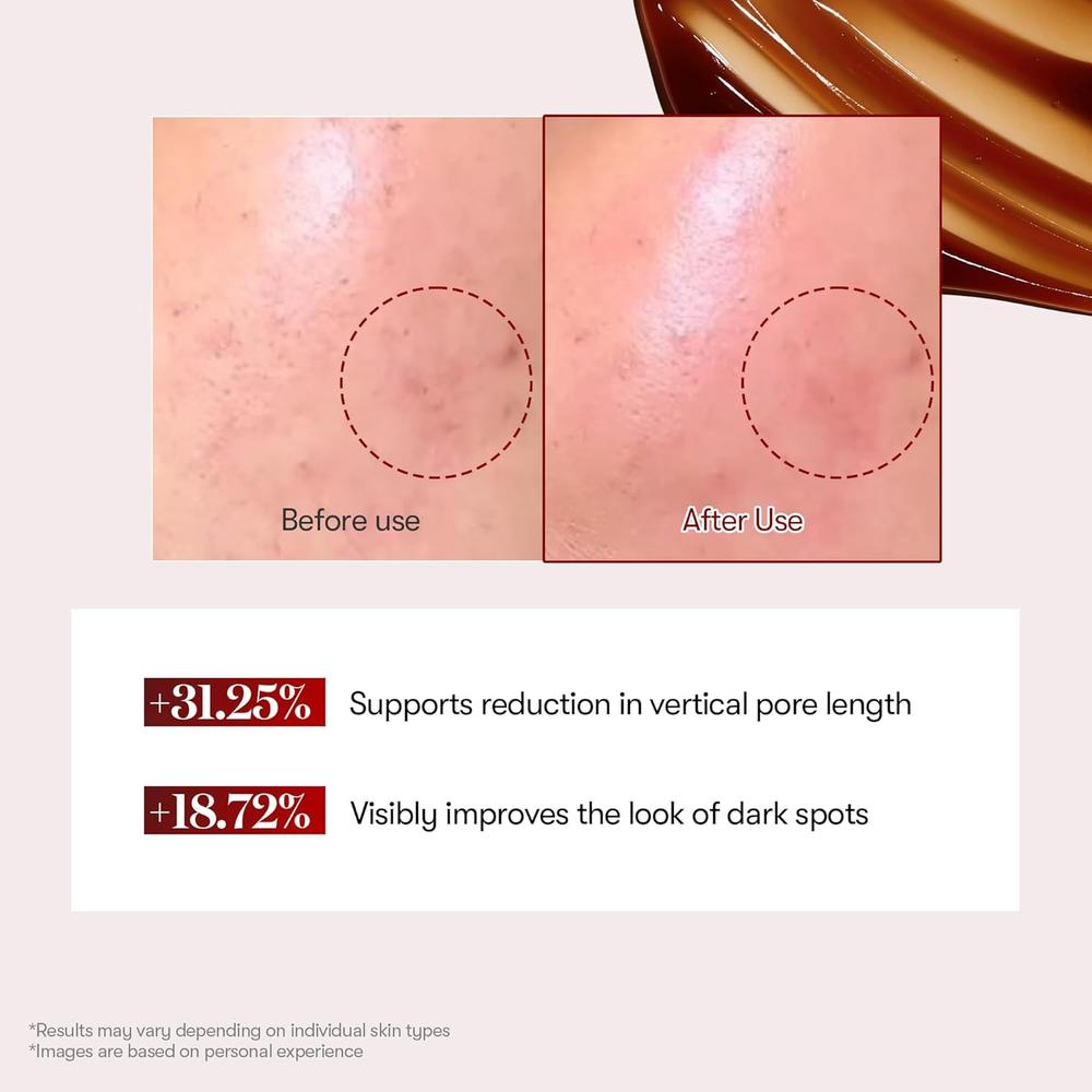 VT COSMETICS RED BOOSTER REEDLE SHOT 100 SUERO DE MICROAGUJAS 50ML - 4