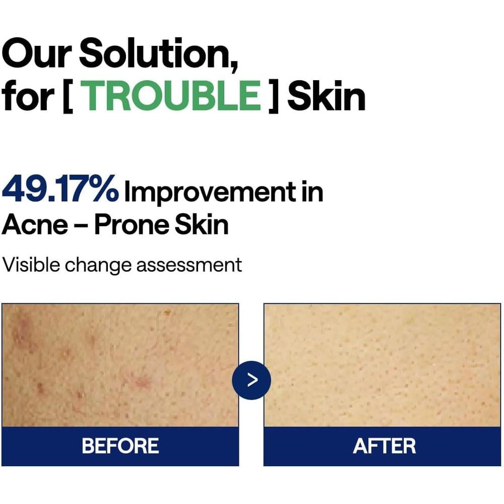 MEDIHEAL TEATREE TROUBLE PAD 100 UDS - 4