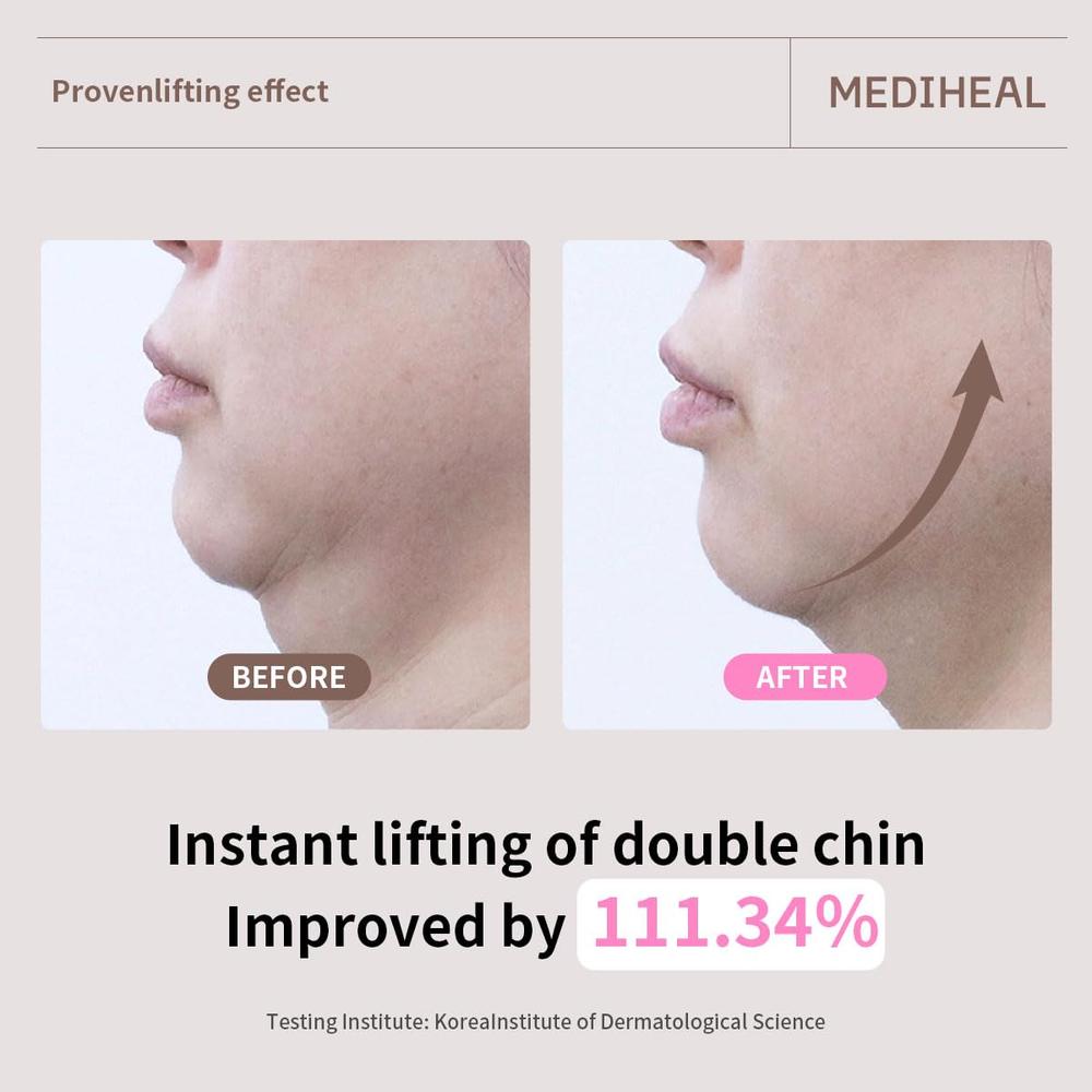 MEDIHEAL MASCARILLA REAFIRMANTE CON COLÁGENO Y RETINOL 10 UDS - 6