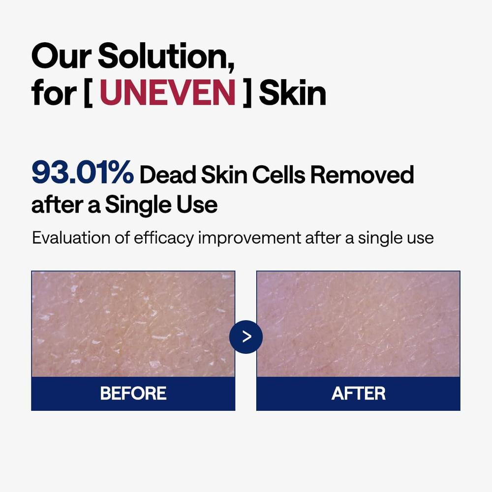 MEDIHEAL DISCOS TĂNICOS FITOENZIMAS 90 UDS - 4