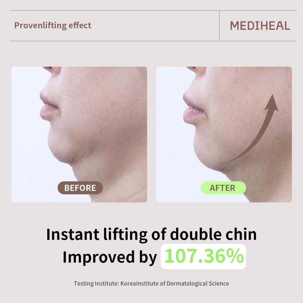 MEDIHEAL MASCARILLA REAFIRMANTE COLÁGENO Y RETINOL 10 UDS - 5