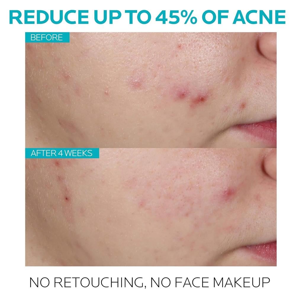 SÉRUM ÁCIDO SALICÍLICO 1.5% TRATAMIENTO ACNÉ EFFACLAR LA ROCHE-POSAY 1 OZ / 30 ML - 2