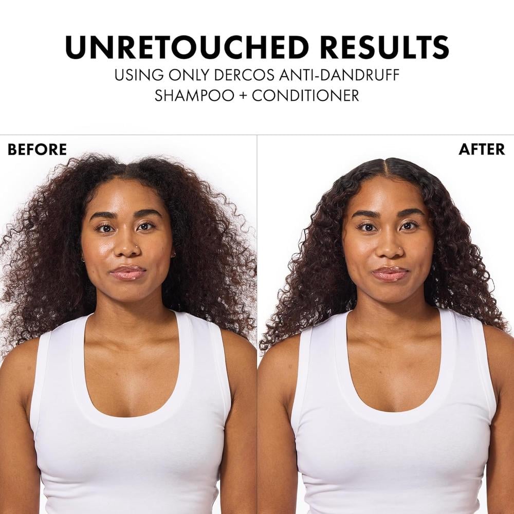 SET CHAMPÚ ANTICASPA Y ACONDICIONADOR VICHY DERCOS 200 ML 2PZS - 2