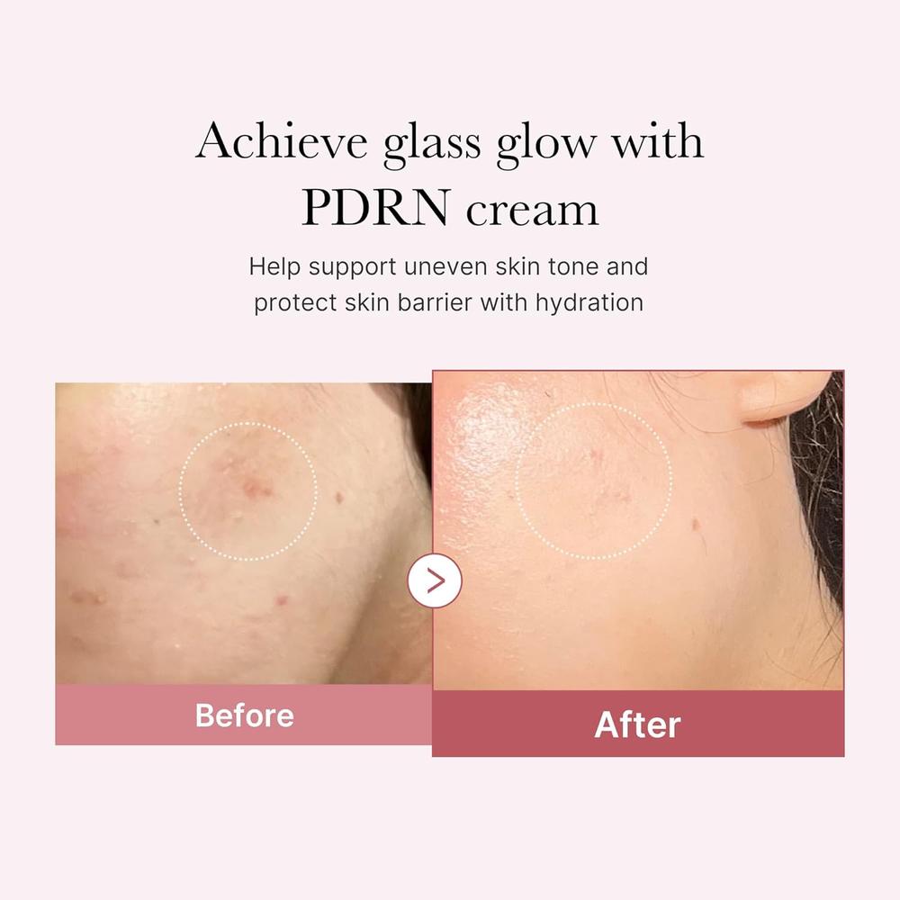 CREMA HIDRATANTE MEDICUBE PDRN PINK HYALURONIC MOISTURIZER 1.7 OZ / 50 ML - 3