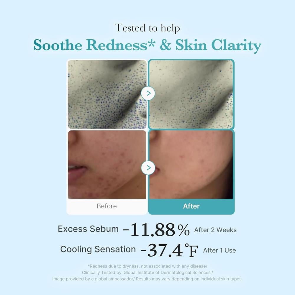 TÓNICO MEDICUBE AZELAIC ACID + NIACINAMIDE TONER 8.45 OZ / 250 ML - 4