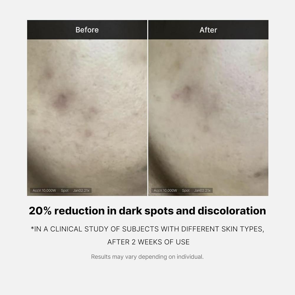 SET SUERO MEDICUBE DEEP VITA C SERUM 2.0 - 3 PZS - 5