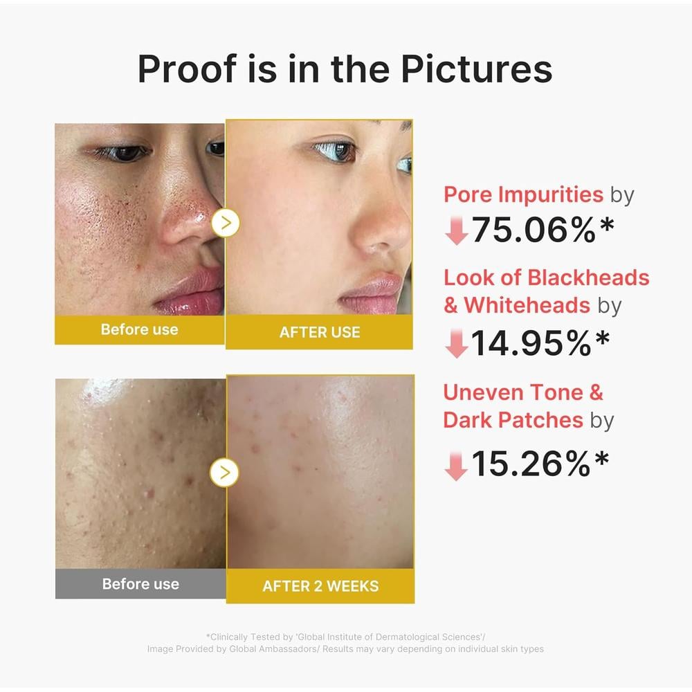 PEELING MEDICUBE ACIDO KOJICO Y CURCUMA 2.70 OZ / 80 ML - 4
