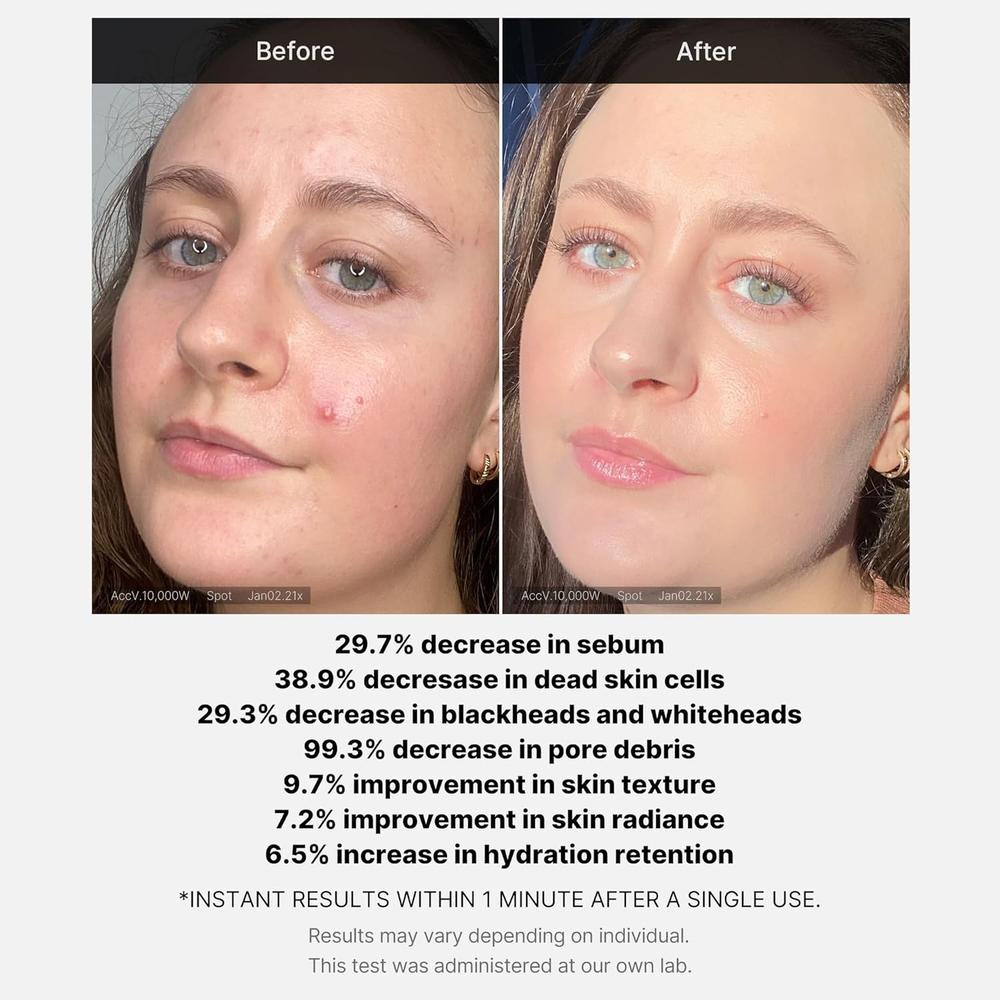 EXFOLIANTE MEDICUBE 21% ACID SERUM 1.38 OZ / 41 ML - 4