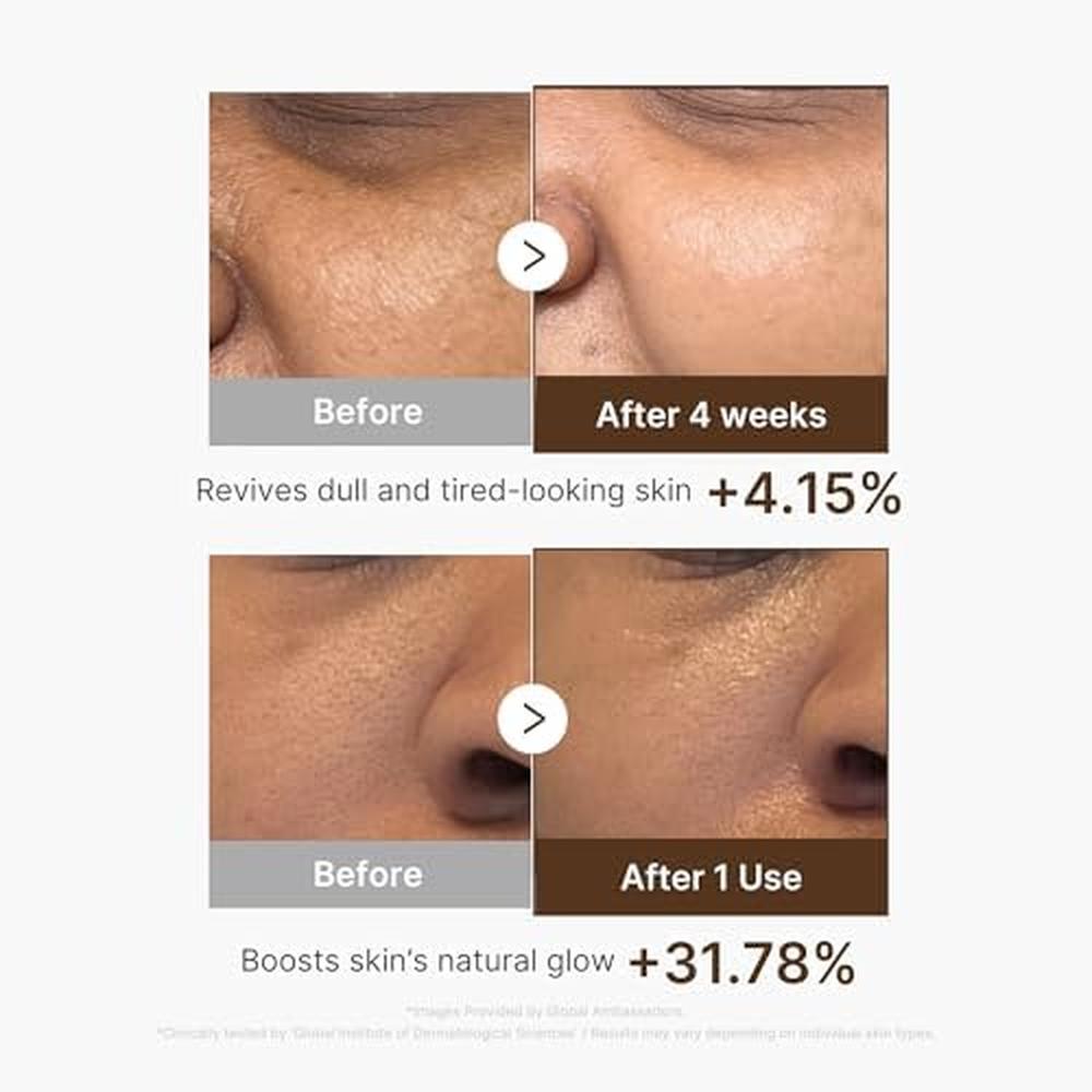 SET MEDICUBE DEEP VITA C RADIANCE PAD Y SERUM 2 PZS - 5