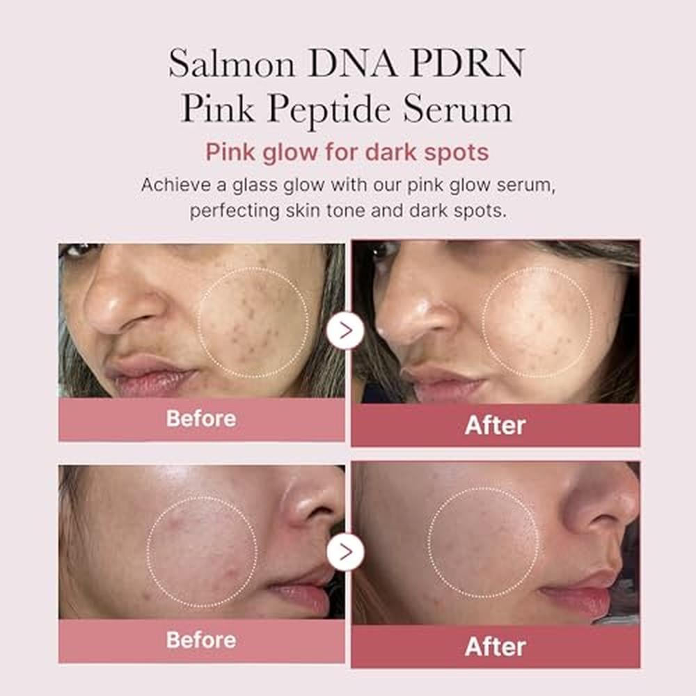 SET MEDICUBE SALMON DNA PDRN PINK PEPTIDE + ONE DAY AMPOULE 10 PZS - 2