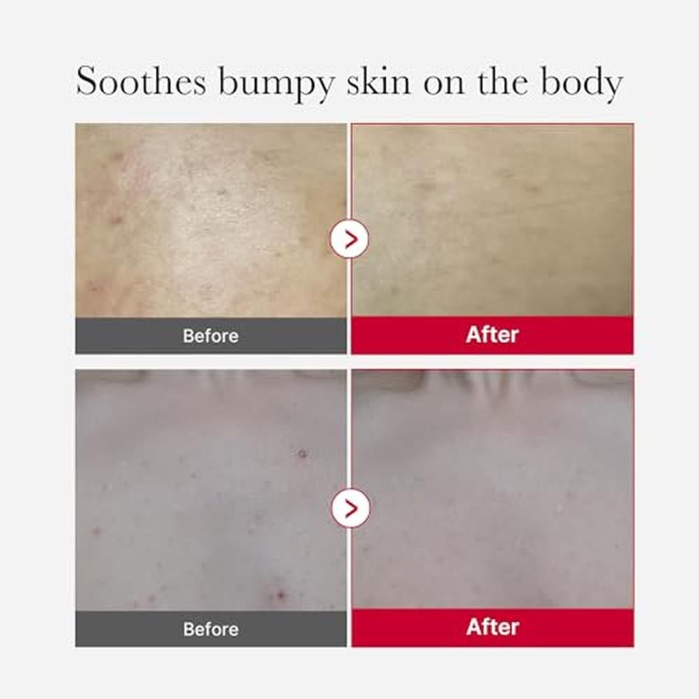 SET MEDICUBE RED BODY CARE PEELING SHOT + BODY WASH + RED BODY GEL SET 3 PZS - 4