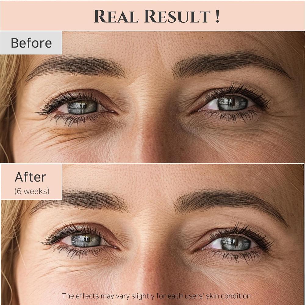 BEAUTY OF JOSEON | SÉRUM DE OJOS REVIVE CON RETINAL Y NIACINAMIDA 2 OZ - 5