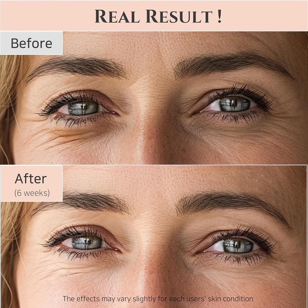 BEAUTY OF JOSEON | SÉRUM DE OJOS REVIVE CON RETINAL Y NIACINAMIDA 1 OZ - 3