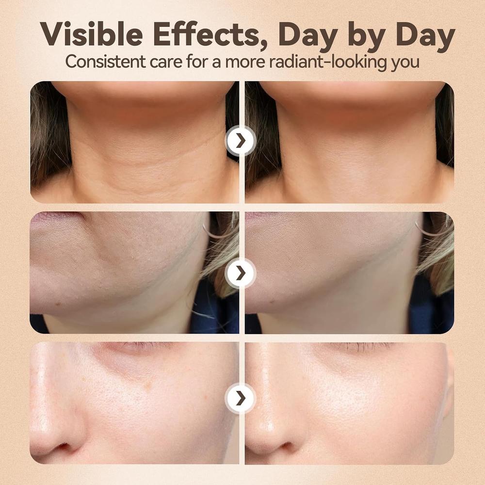 MASAJEADOR FACIAL 3 EN 1 CON VIBRACIÓN BLANCO - 3
