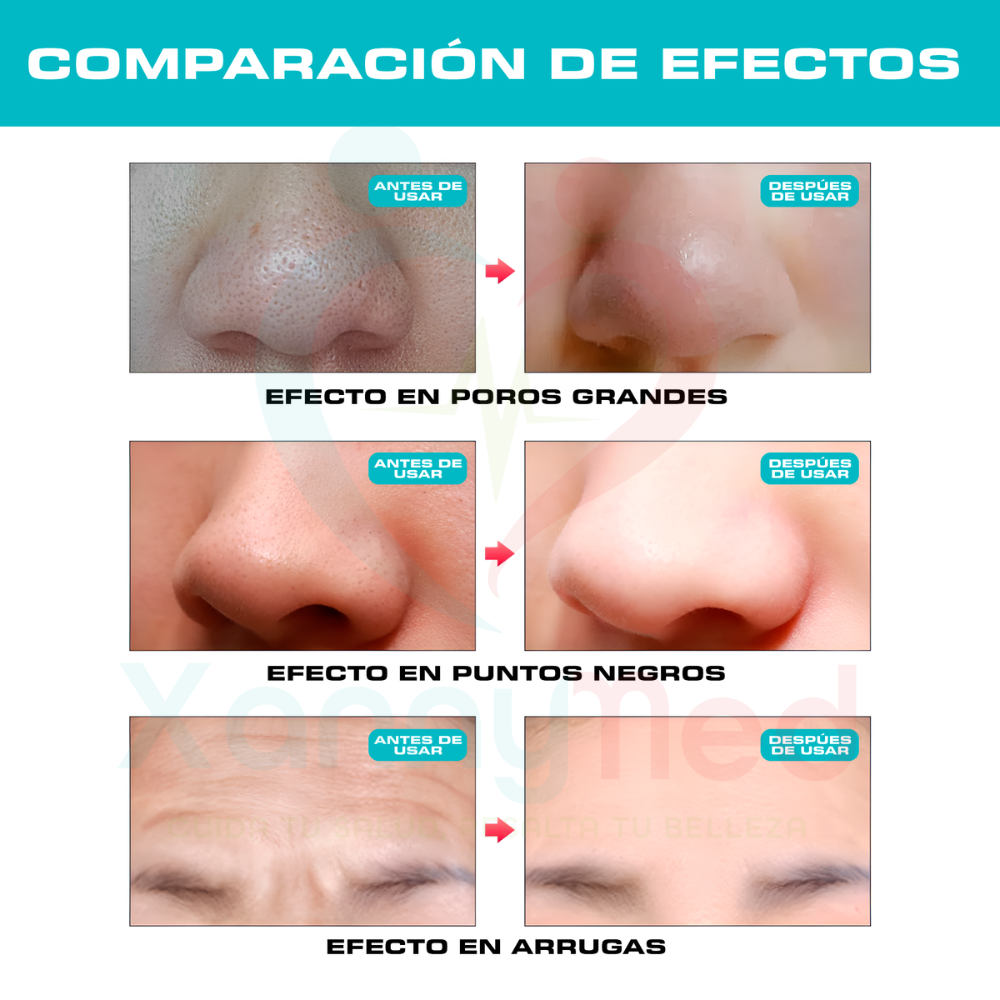 MÁSCARA LED 7 COLORES FOTOTERAPIA ACNE ANTIAGE - 4