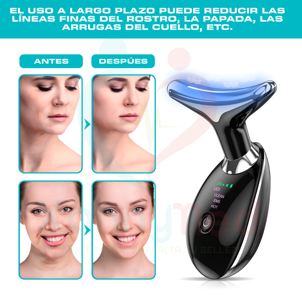 RADIO FRECUENCIA FACIAL Y DE PAPADA PORTATIL - 3