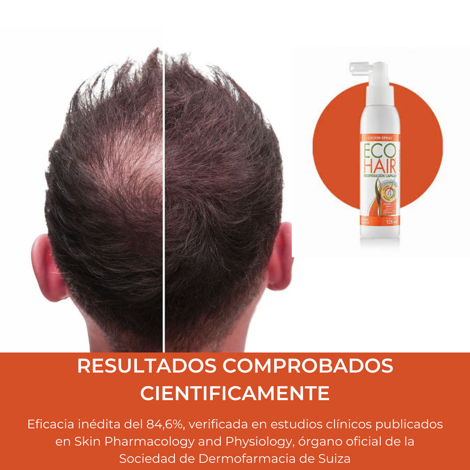LOCIÓN ECO HAIR 125ML SPRAY RECUPERACIÓN CAPILAR - 3