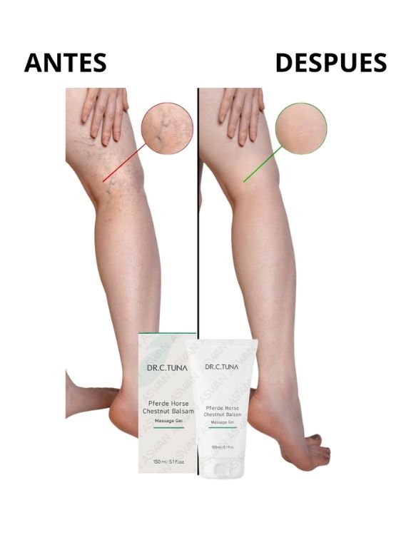 GEL CON EXTRACTO DE CASTAÑO DE INDIAS PARA VARICES 150 ML - FARMASI - 2