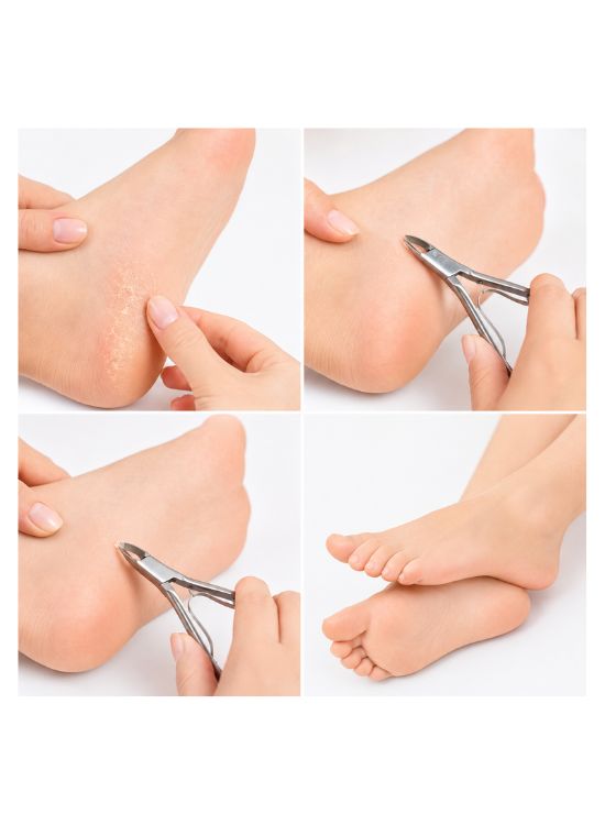 ALICATE DE PIE PARA PEDICURE - MC NAILS - 3