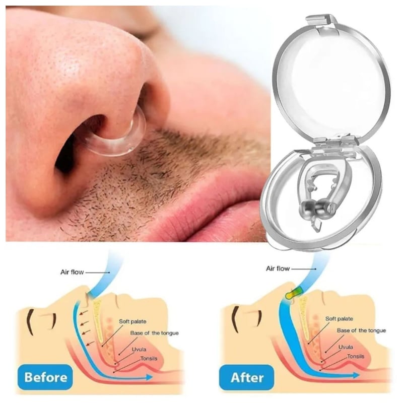 CLIP NASAL OEM NOSECLIP ANTIRRONQUIDOS PARA DEJAR DE RONCAR - 2