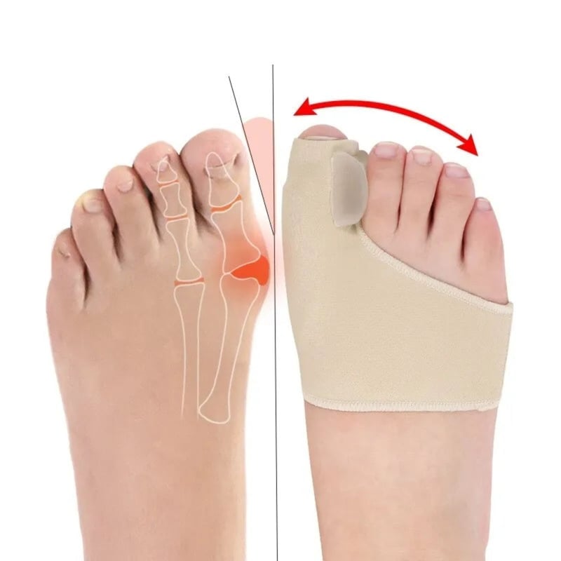 CORRECTOR JUANETE PARA DEDO DE LOS PIES - 1