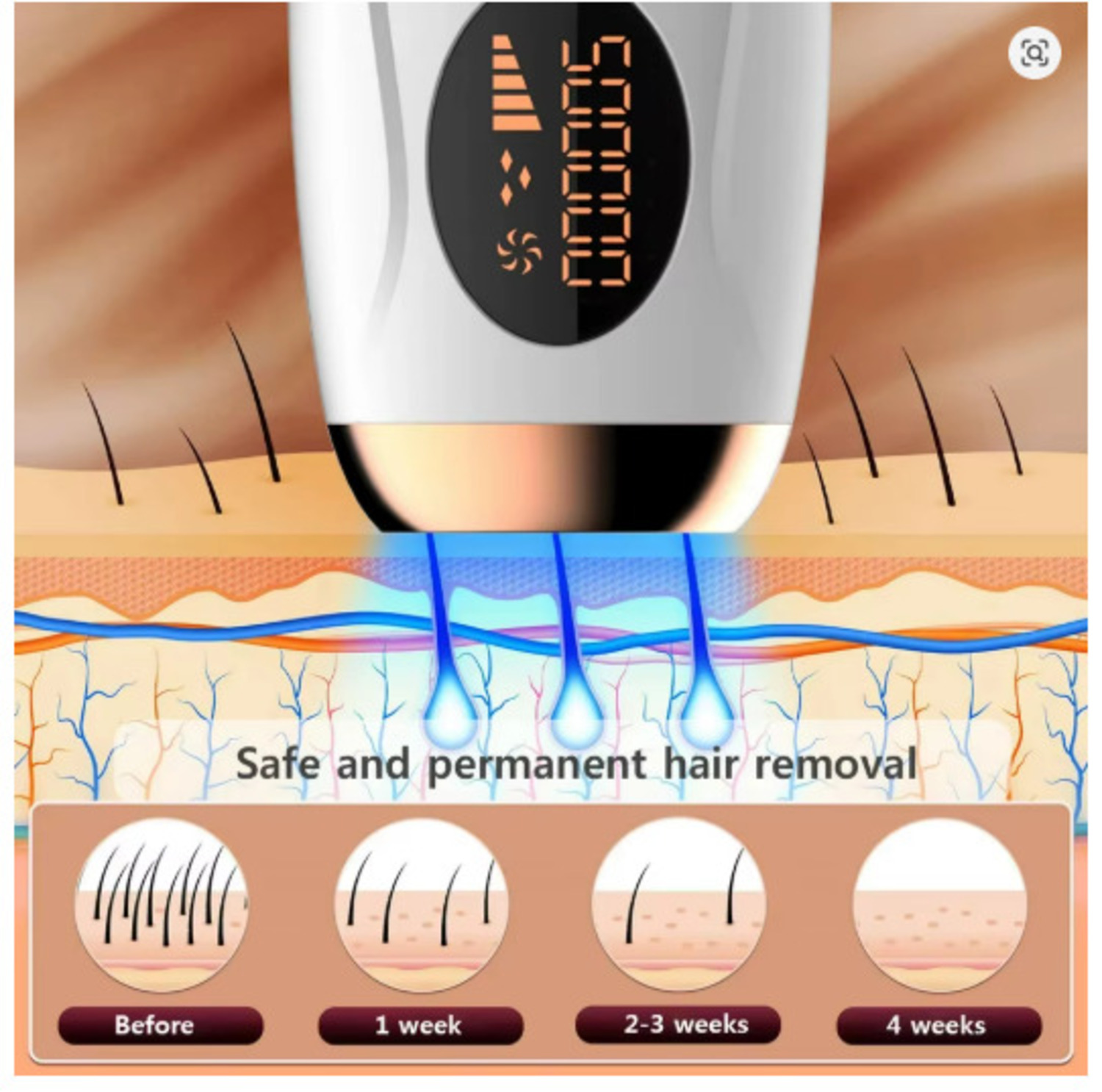 DEPILADORA LASER IPL PROFESIONAL PARA CASA - TECNOLOGÍA DE LUZ PULSADA CON 5 NIVELES - 2