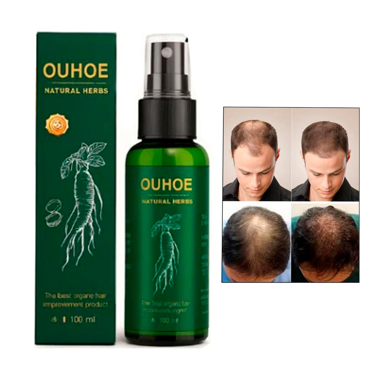 CONTROL DE CAIDA Y CRECIMIENTO DE CABELLO 100 ML - 1