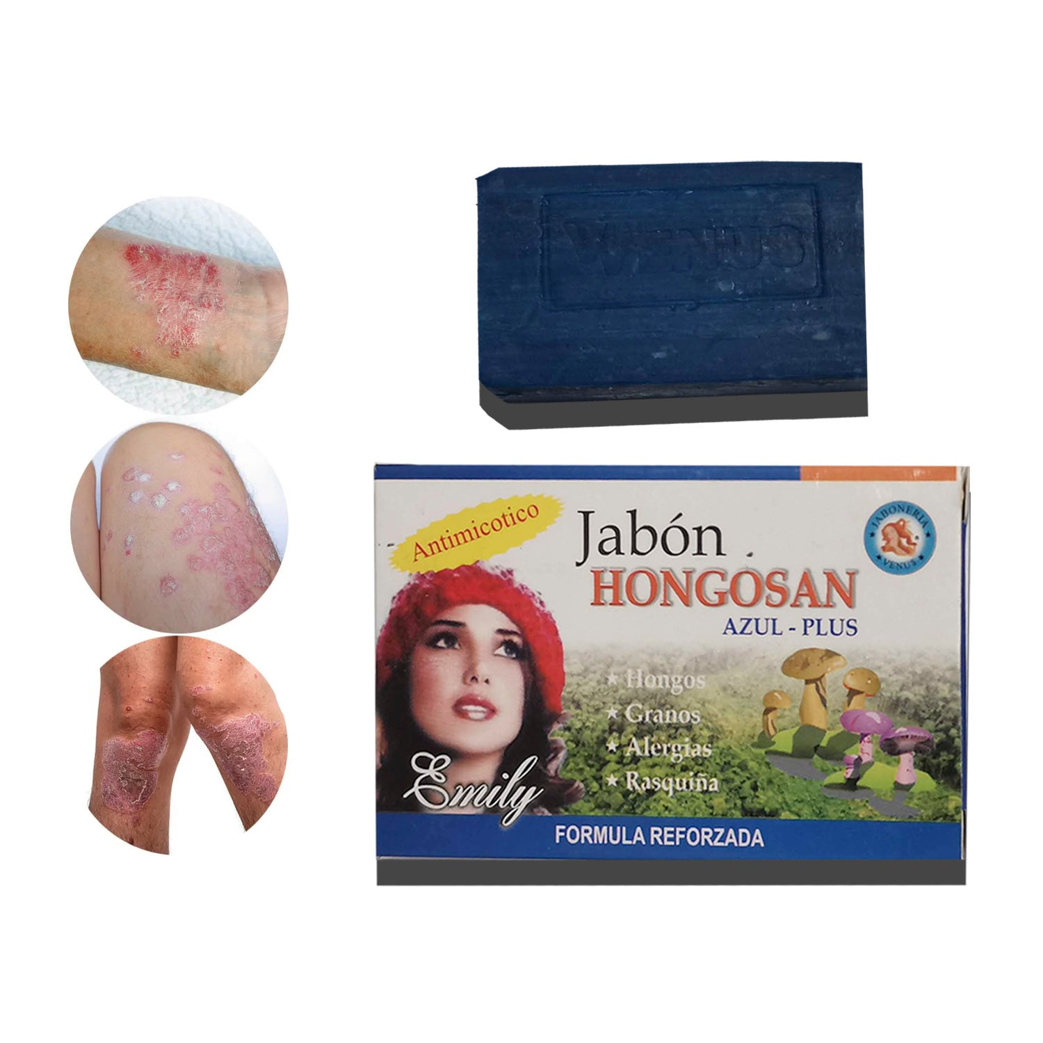 JABON MEDICINAL PARA HONGOS, TIÑA , SORIASIS 2 UNIDADES - 2