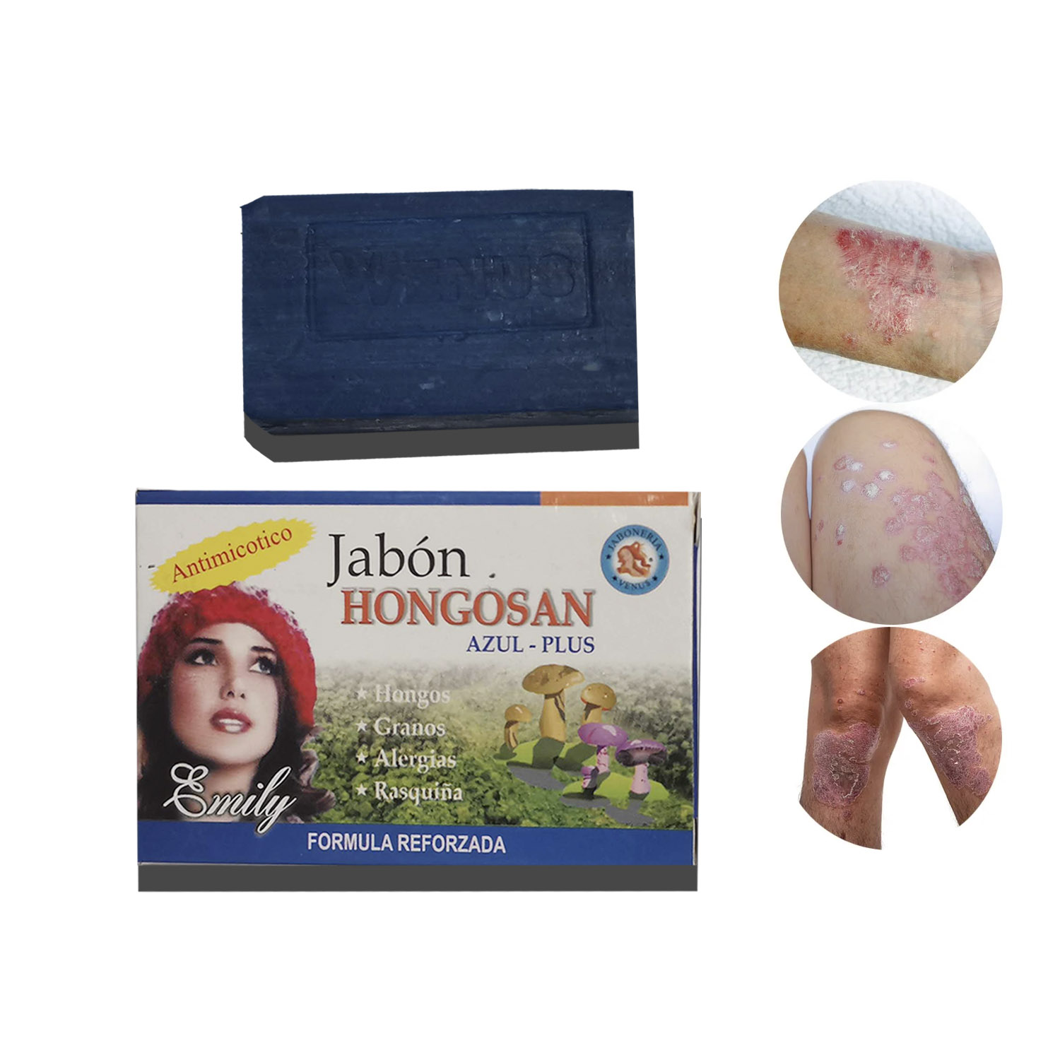 JABON MEDICINAL HONGOSA PIE DE ATLETA, TIÑA 2 UND - 1