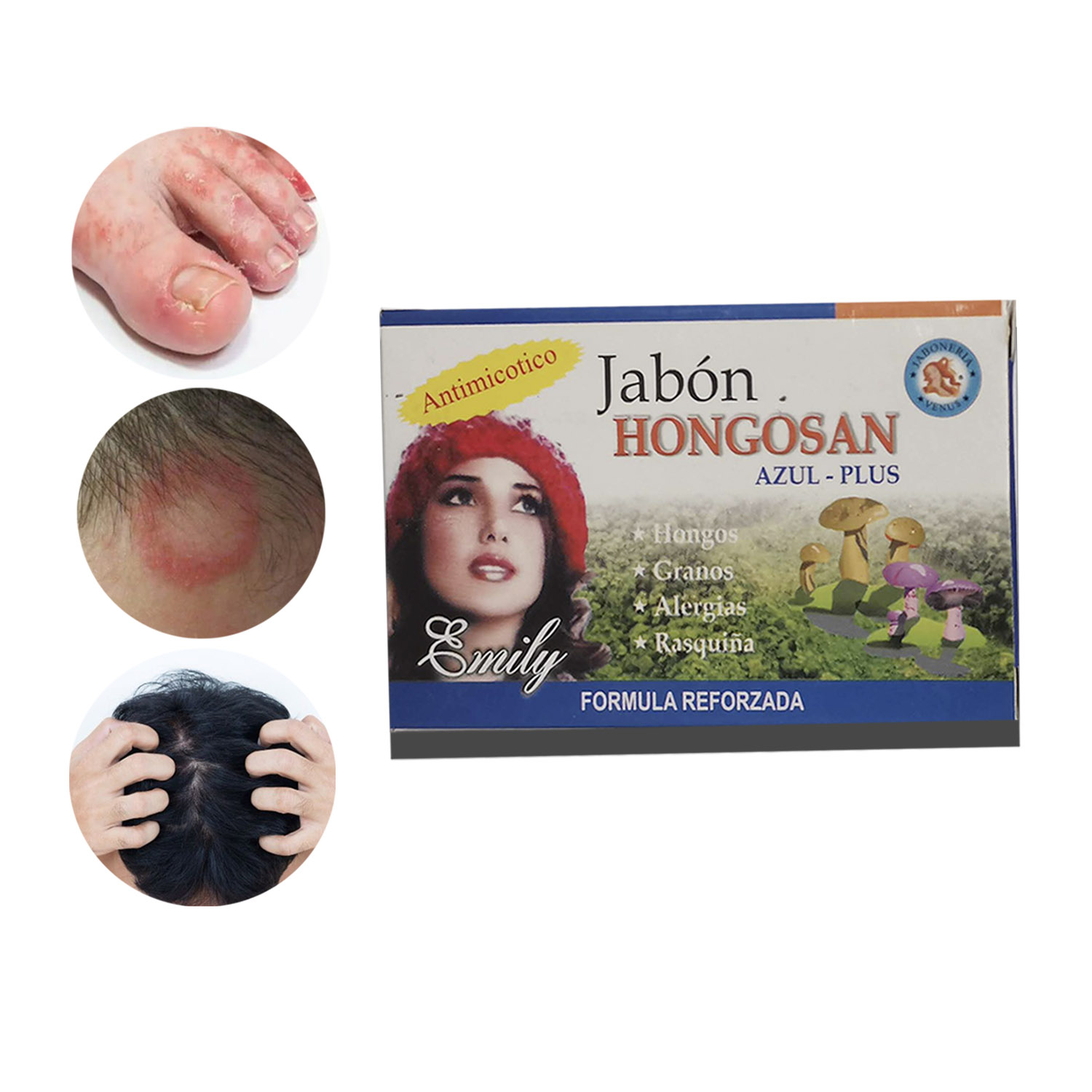 JABON MEDICINAL PARA HONGOS PIE DE ATLETA, TIÑA 2 UND - 1