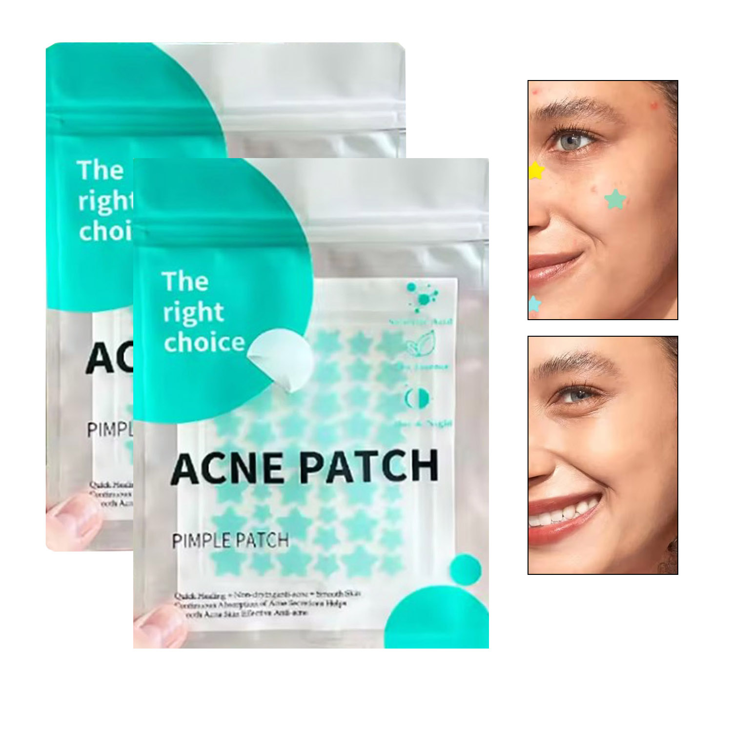 PARCHE PARA ELIMINAR ACNE BARROS Y ESPINILLAS 100 UND - 2