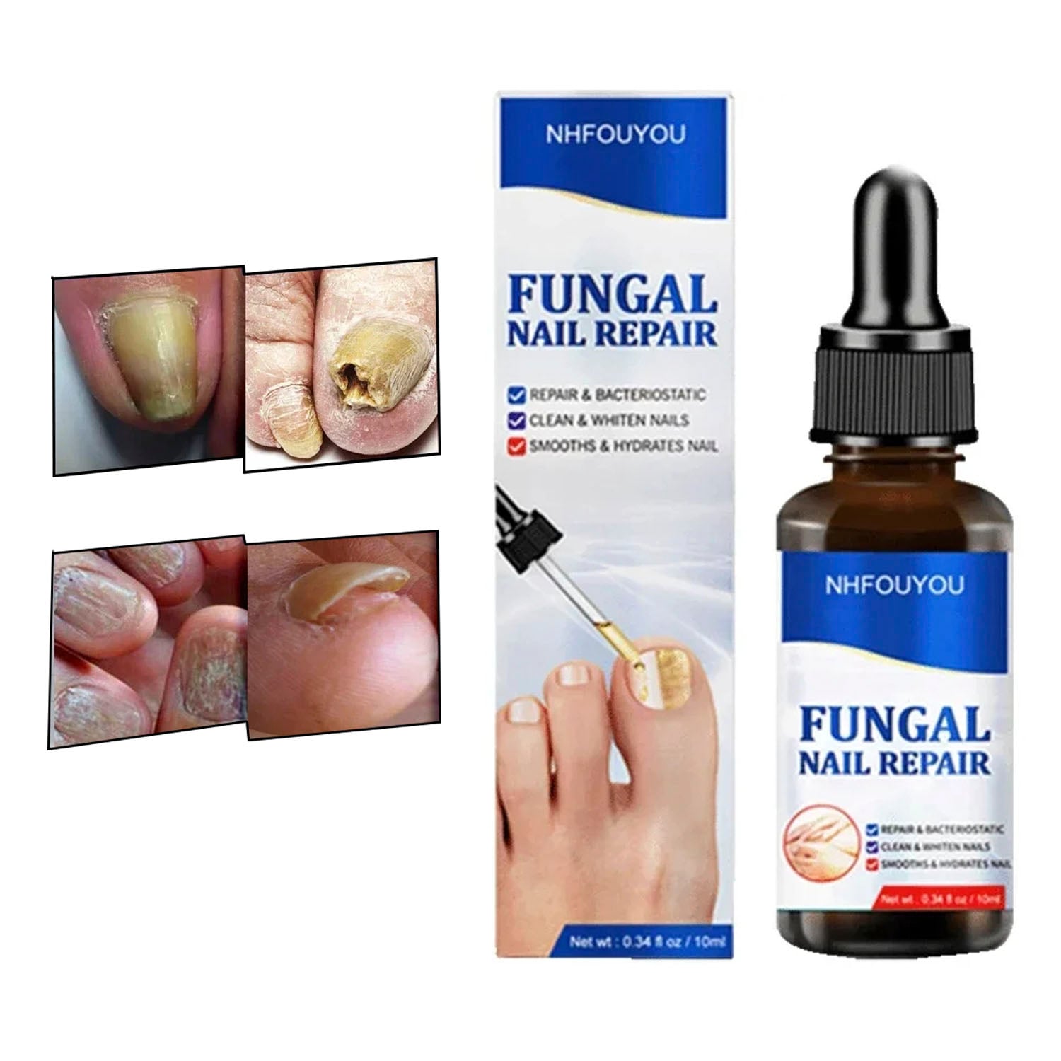 GOTAS PARA HONGOS EN UÑAS - PIES Y MANOS FORMULA MEJORADA - 1