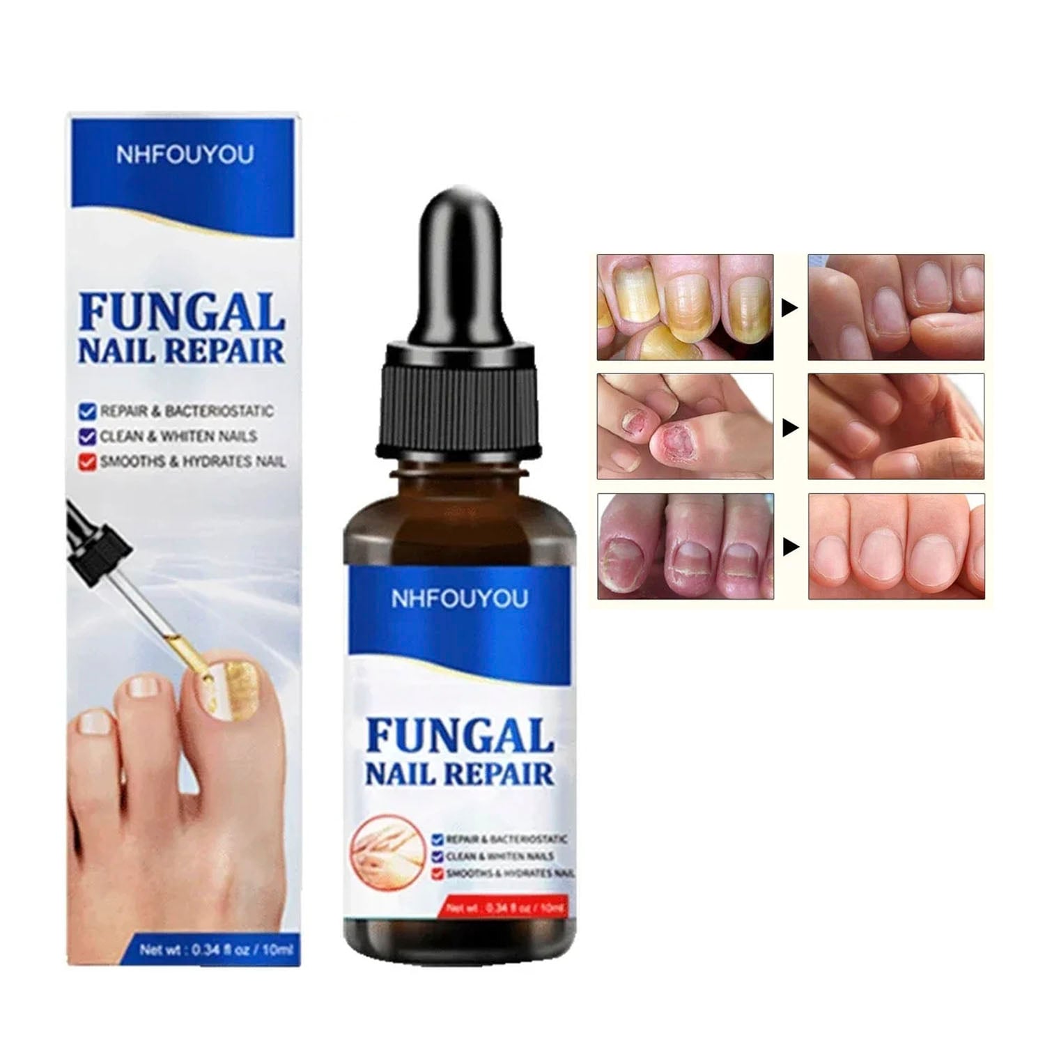 GOTAS PARA HONGOS EN UÑAS - PIES Y MANOS FORMULA MEJORADA - 2