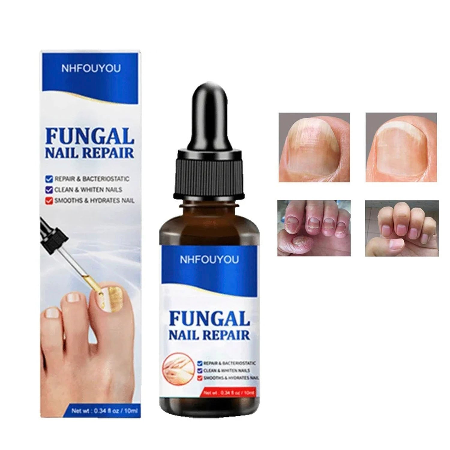 GOTAS PARA HONGOS EN UÑAS - PIES Y MANOS FORMULA MEJORADA - 3