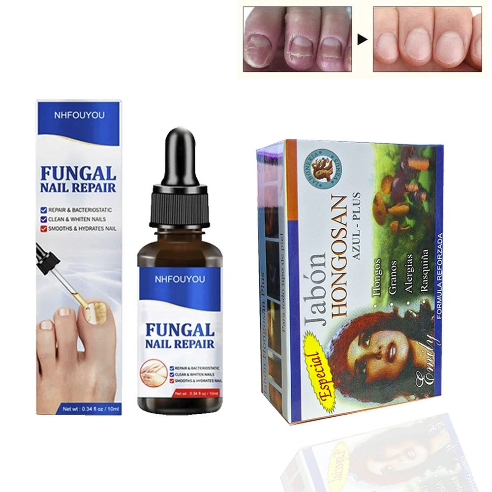 KITS TRATAMIENTO PARA HONGOS EN UÑÀS DE PIE Y MANO - 1