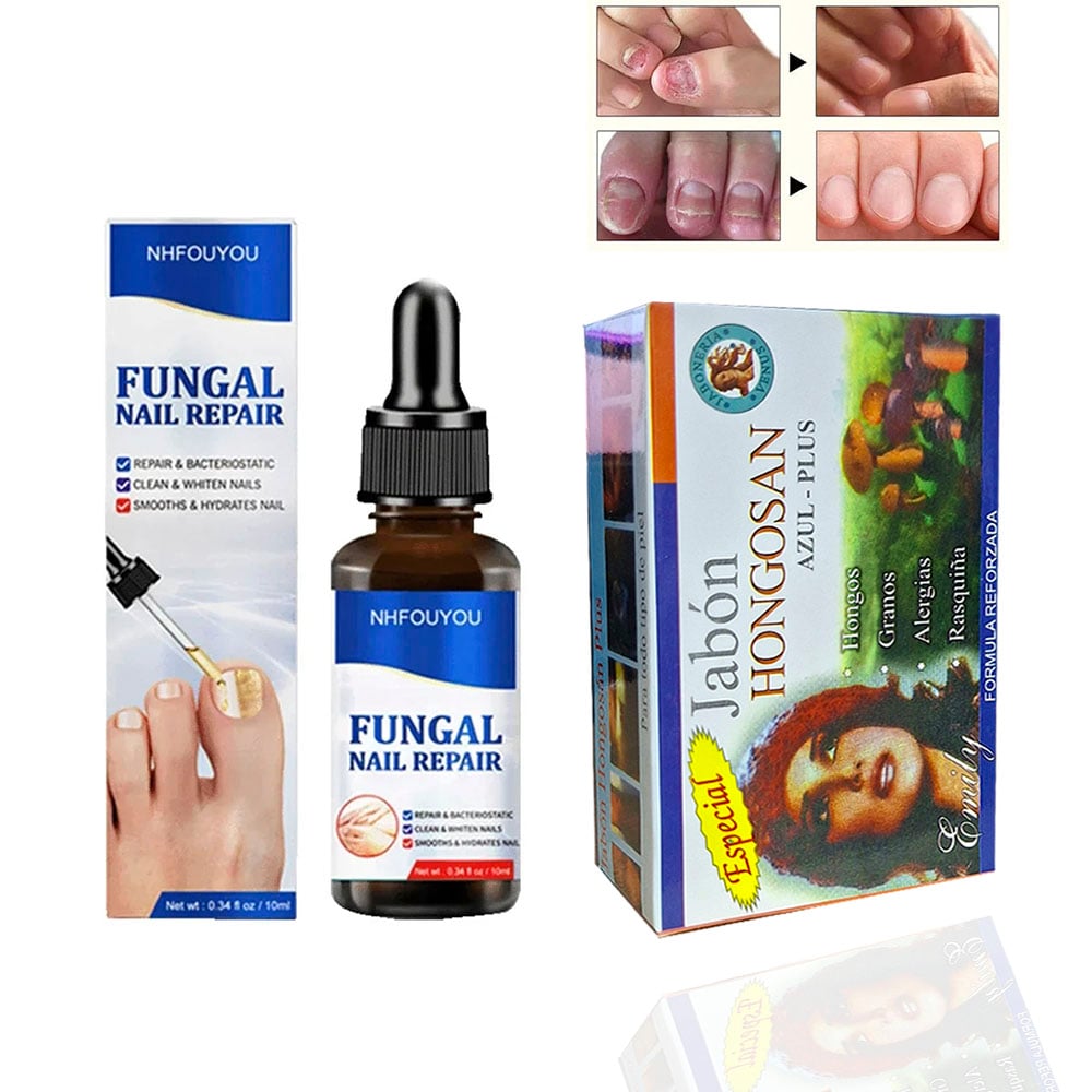 KITS TRATAMIENTO PARA HONGOS EN UÑÀS DE PIE Y MANO - 3