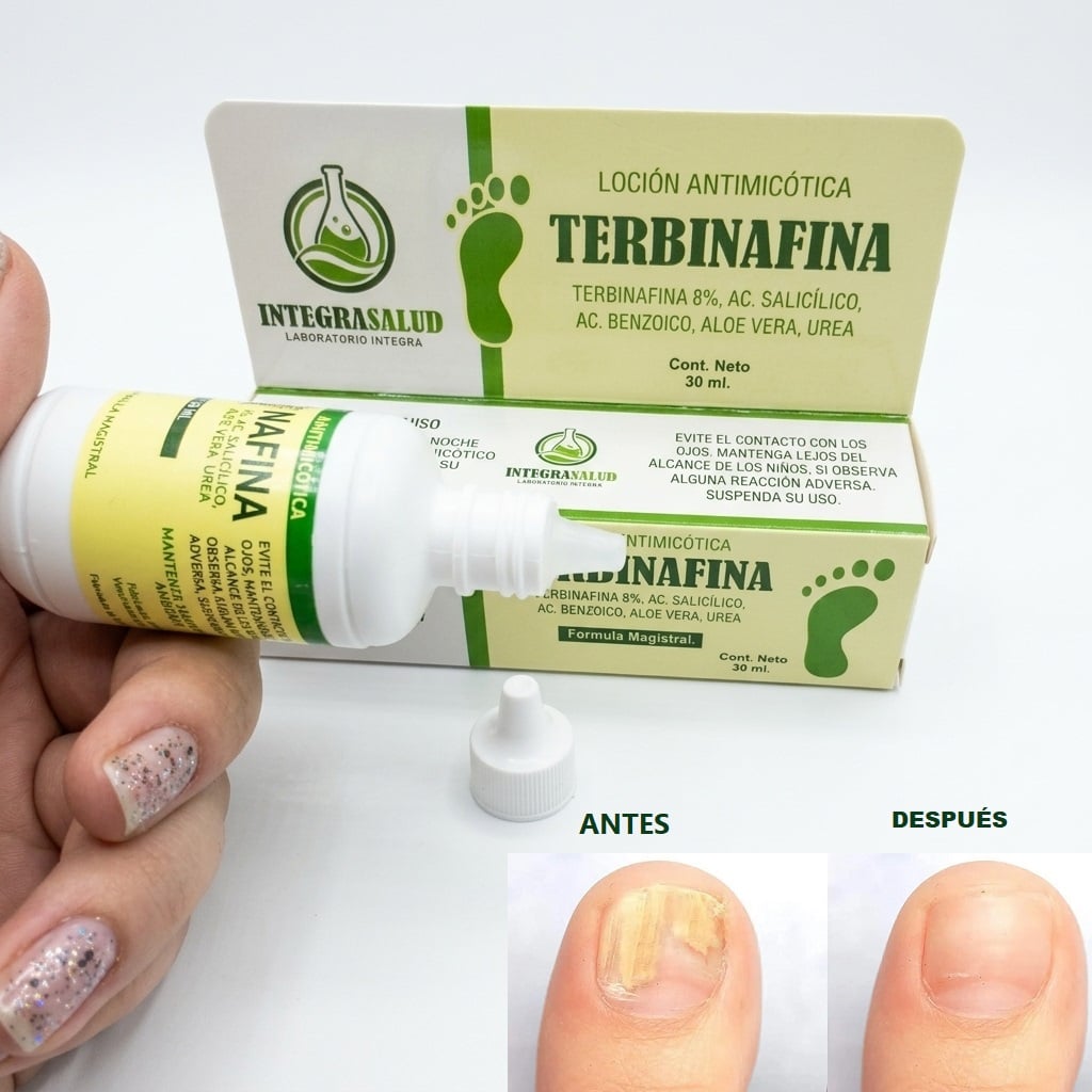 2 TERBINAFINA S 8% EN GOTAS PARA TRATAMIENTO  DE HONGOS EN LAS UÑAS Y PIES - 1