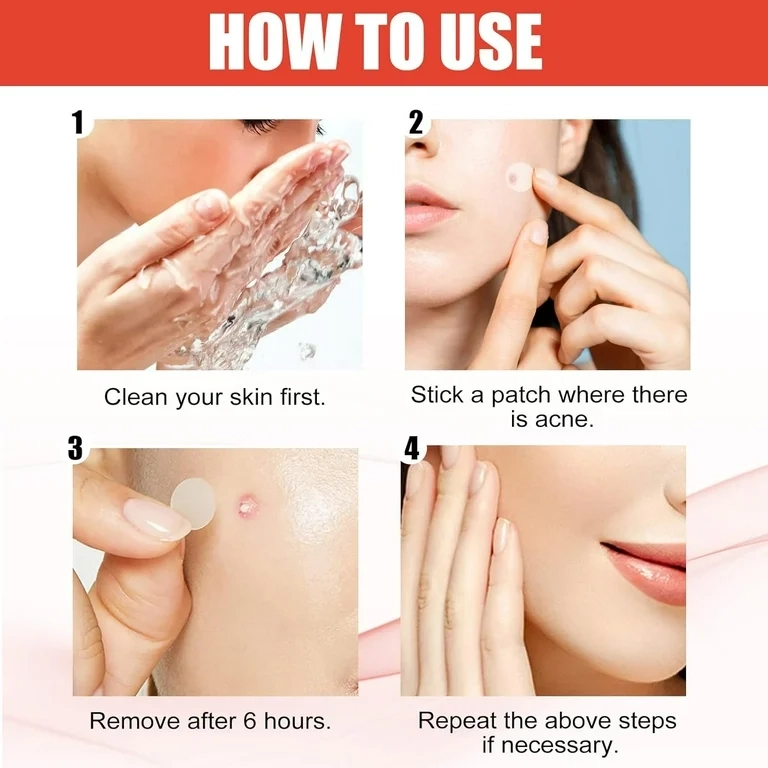 PARCHES ANTI GRANOS HIDROCOLOIDE ESPINILLAS TRATAMIENTO ANTIACNE 200 UNIDADES - 6