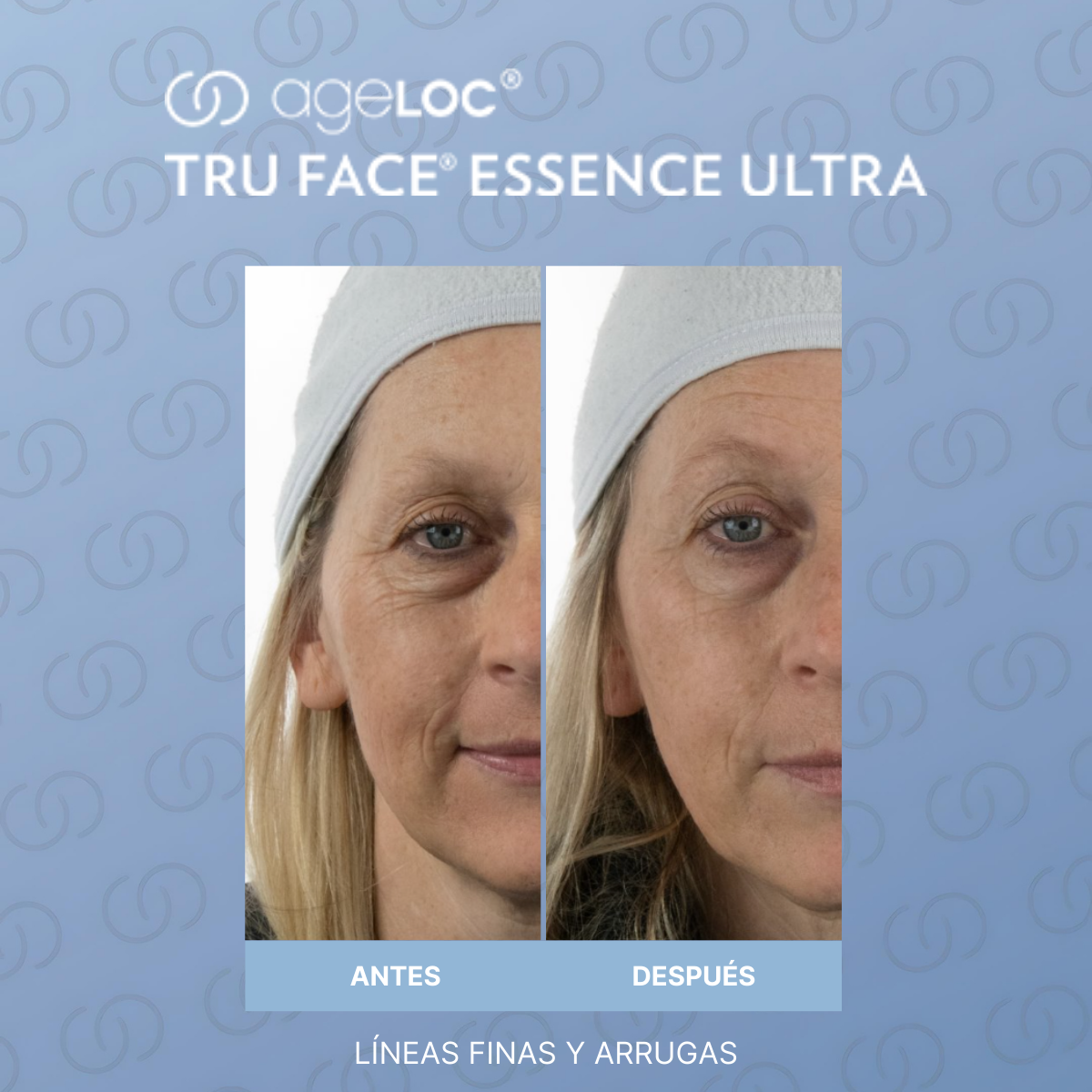 NU SKIN TRU FACE ESSENCE ULTRA- 30 PERLITAS PARA FIRMEZA ROSTRO - CUELLO
MADE IN USA!! - 6