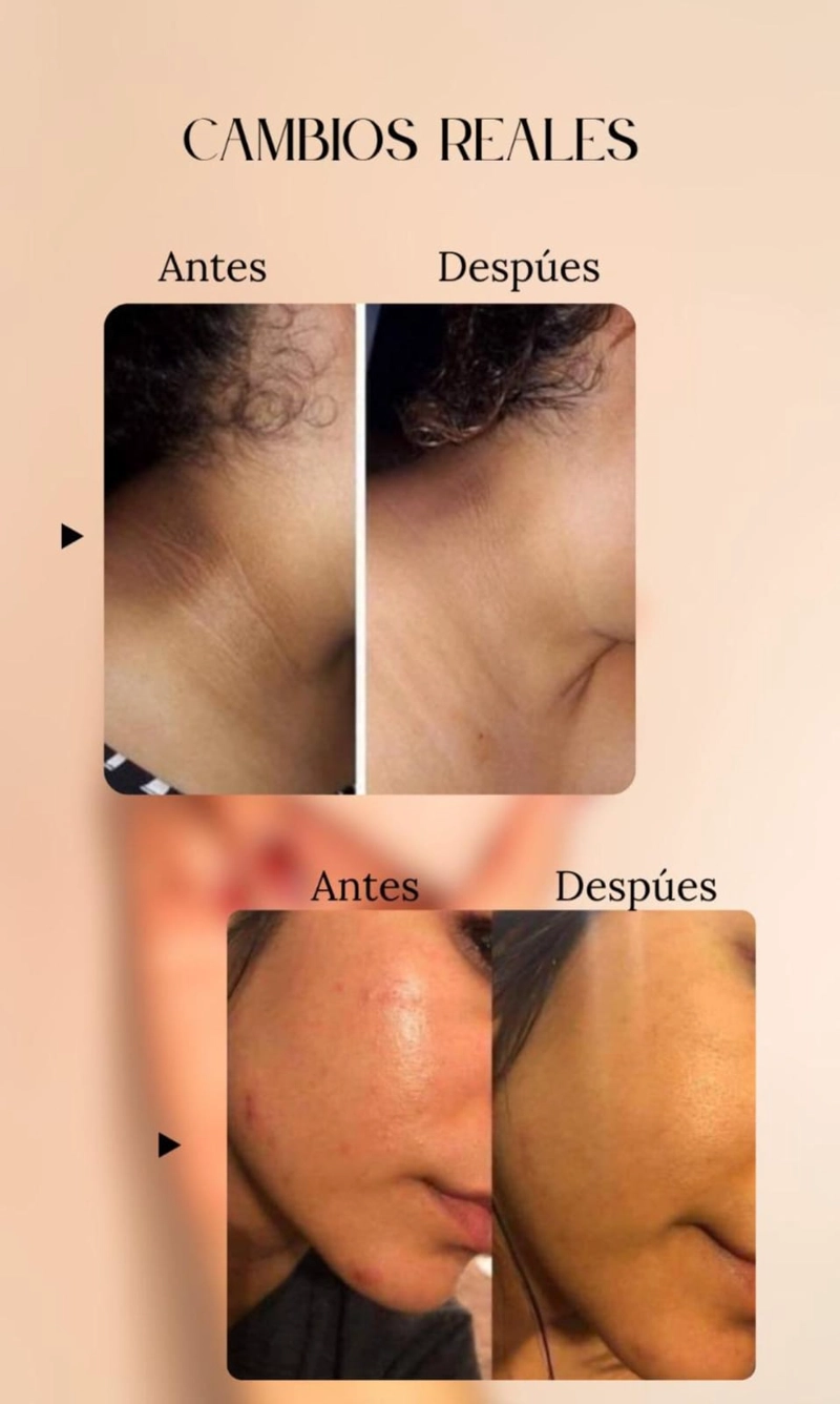 EPOCH POLISHING BARRA EXFOLIANTE (PACK 2 UNID) - NU SKIN - USA!!!!PARA UNA PIEL SIN MANCHAS NI ACNE. - 3