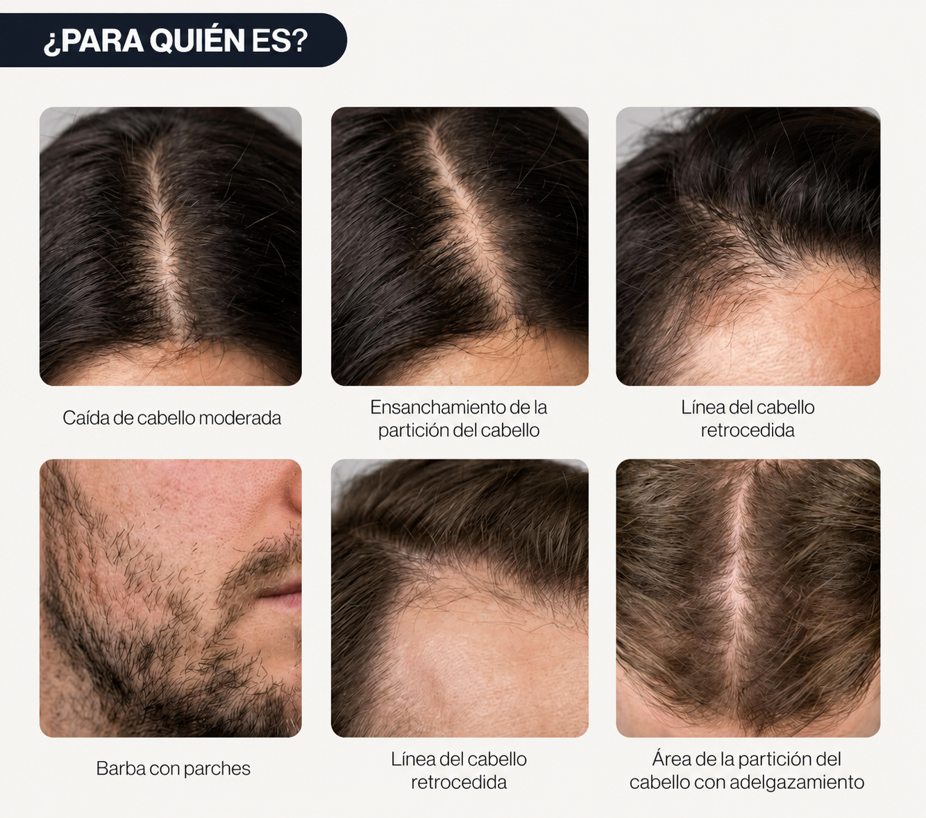 BODYWISE ROLL ON CRECIMIENTO CAPILAR Y BARBA CON ROMERO, SAW PALMETTO Y CAFEÍNA | REDUCE CAÍDA Y FORTALECE - 3