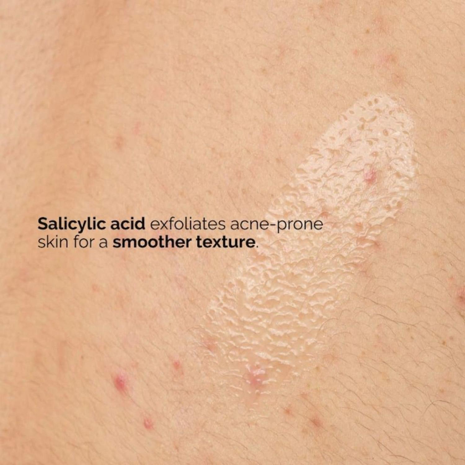 SÉRUM CORPORAL EXFOLIANTE THE ORDINARY CON ÁCIDO SALICÍLICO AL 0,5 % PARA EL ACNÉ - 240 ML - 2