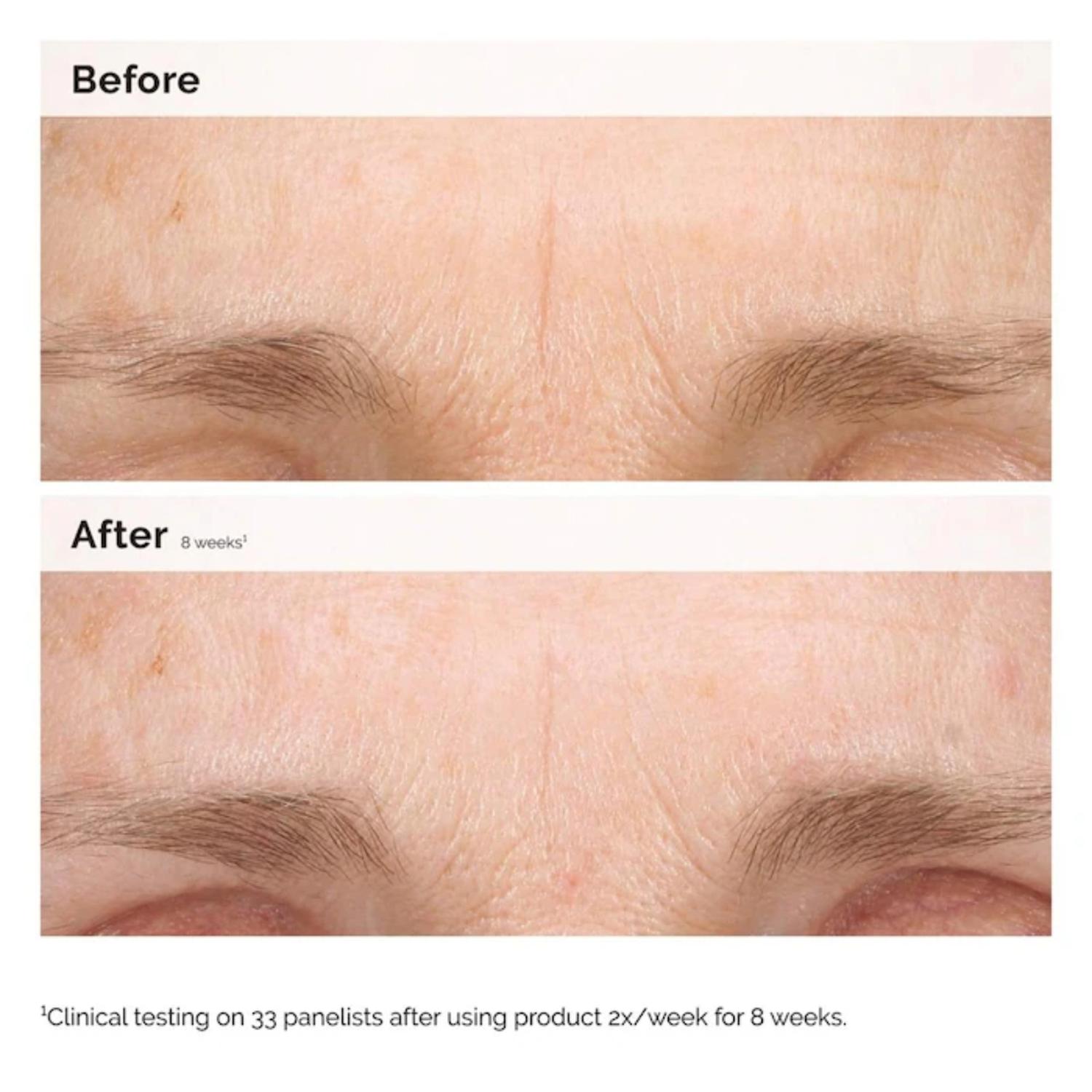 SERUM THE ORDINARY RETINAL 0.2% EMULSION 15ML - 1