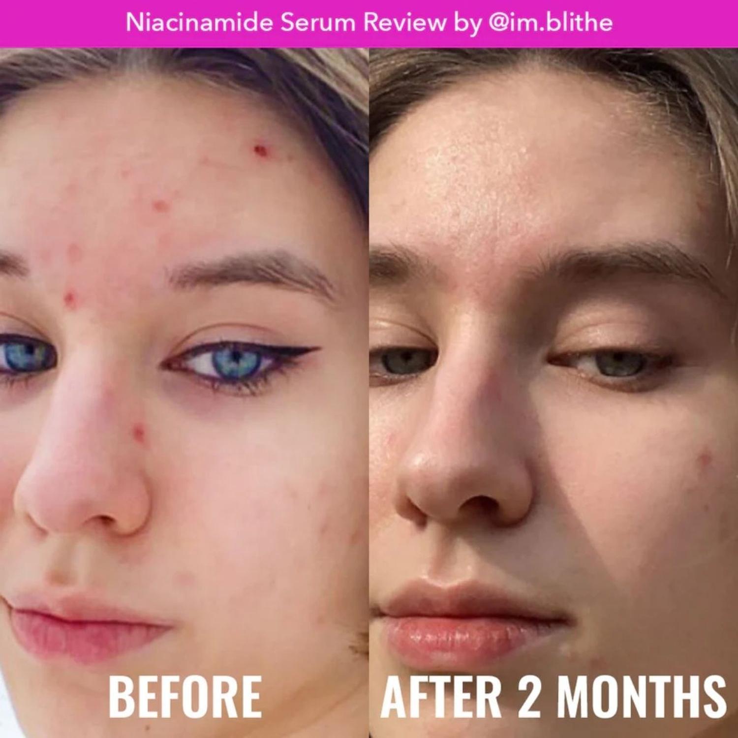 SERUM NIACINAMIDE GOOD MOLECULES - 30 ML - 3