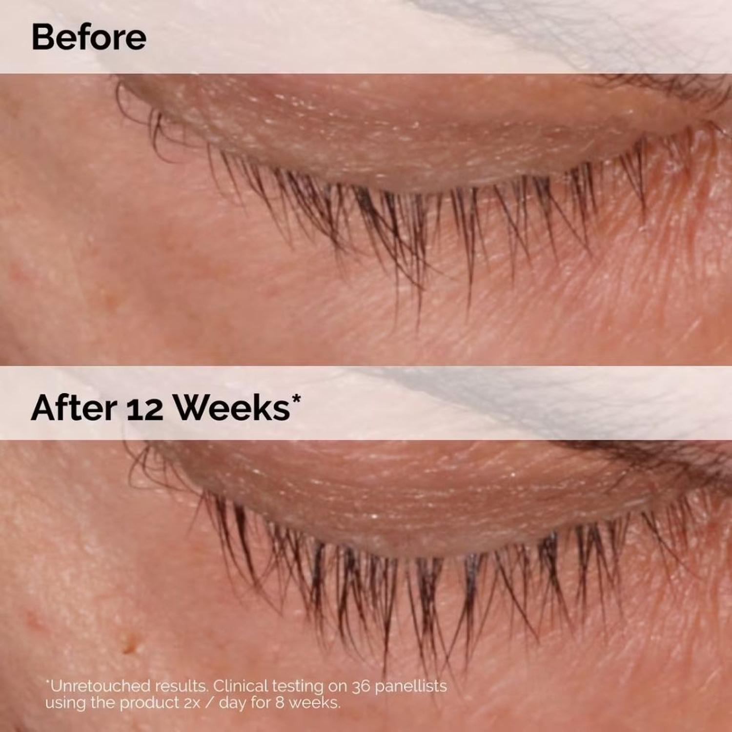THE ORDINARY SUERO MULTIPÉPTIDO PARA PESTAÑAS Y CEJAS 5 ML - 4