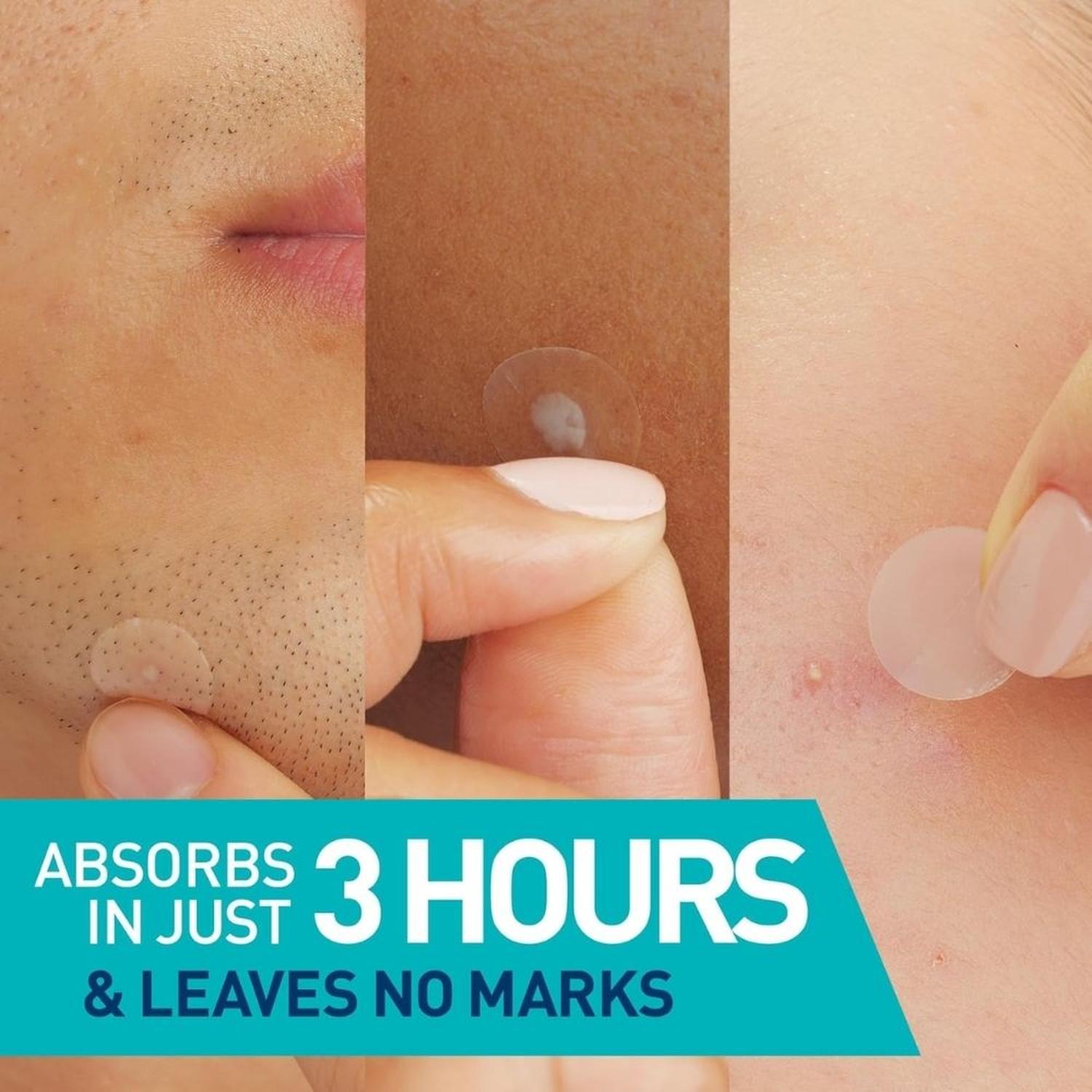 PARCHES HIDROCOLOIDES PARA MANCHAS QUE ABSORBEN EL ACEITE CERAVE - 2