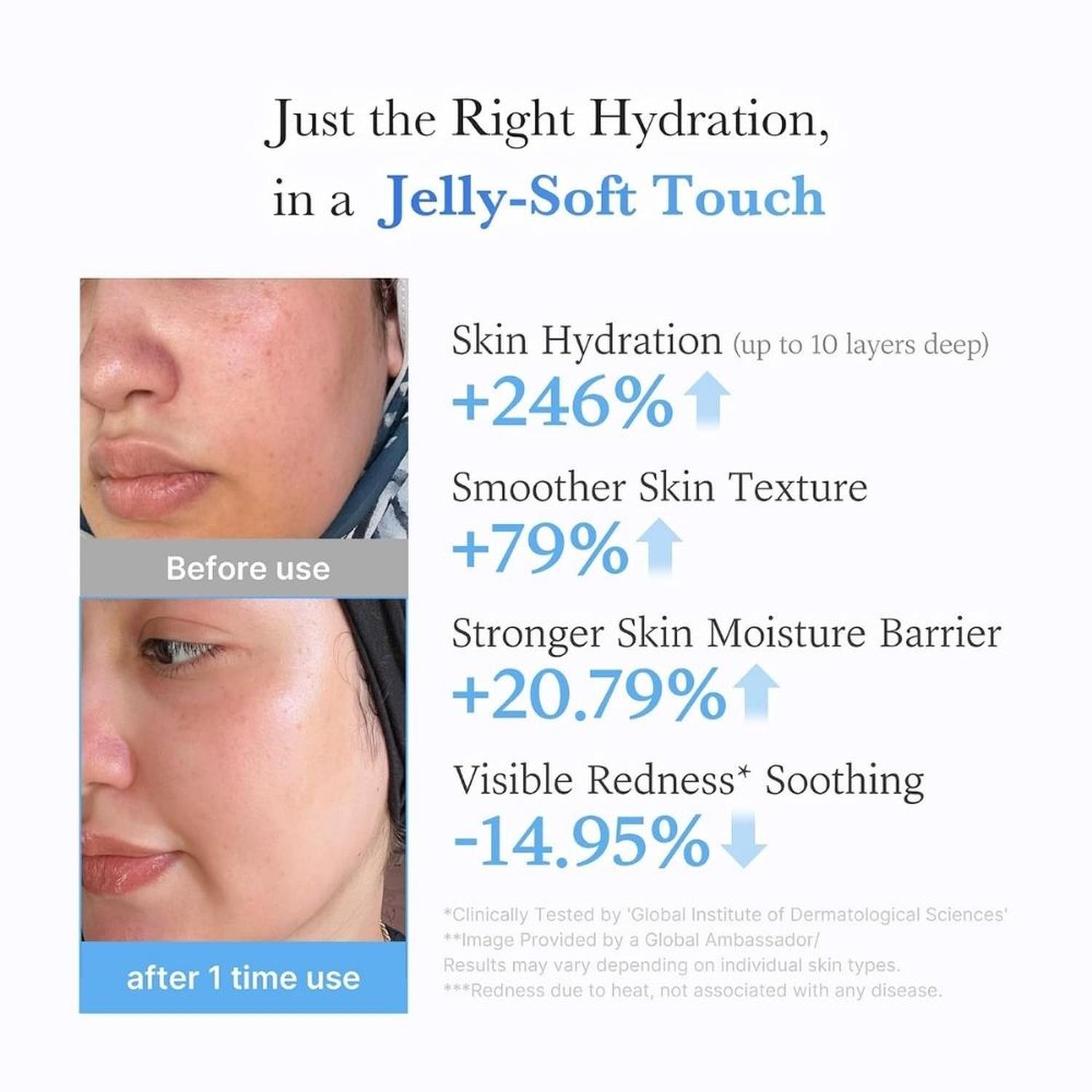 CREMA EN GEL MEDICUBE CON ACIDO HIALURONICO Y NIACINAMIDE - 50 ML - 4