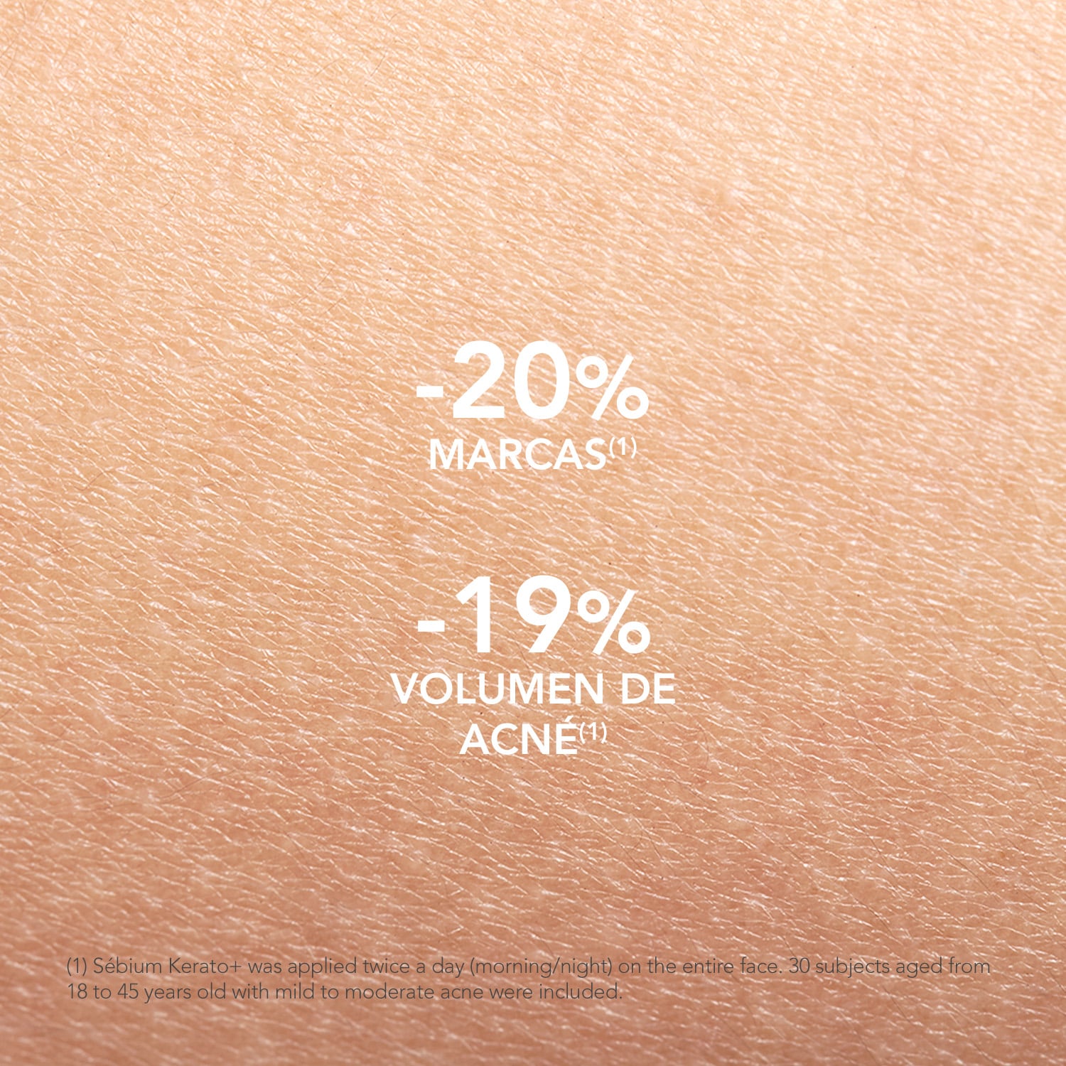GEL CREMA BIODERMA SÉBIUM KERATO+ 30ML - 6